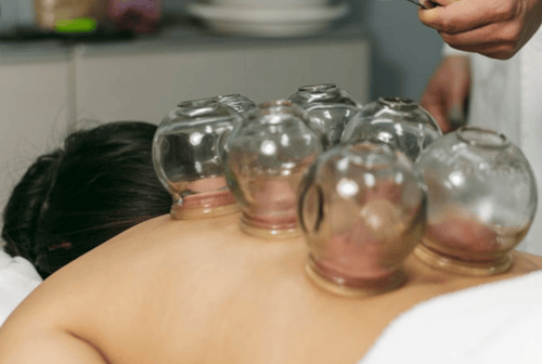 Cupping Treatment Thumbnail