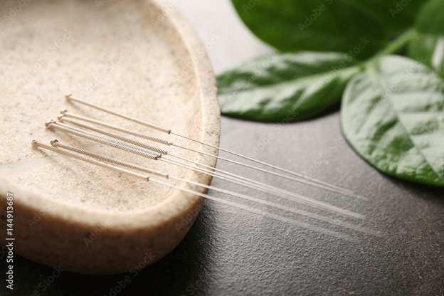 Acupuncture vs Dry Needling