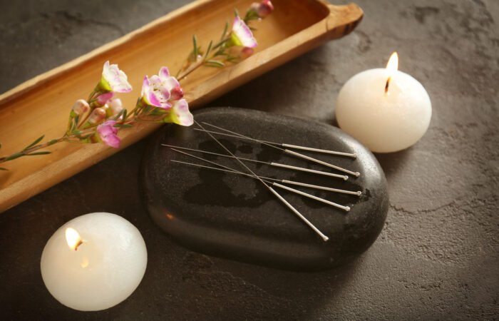 acupuncture for beauty