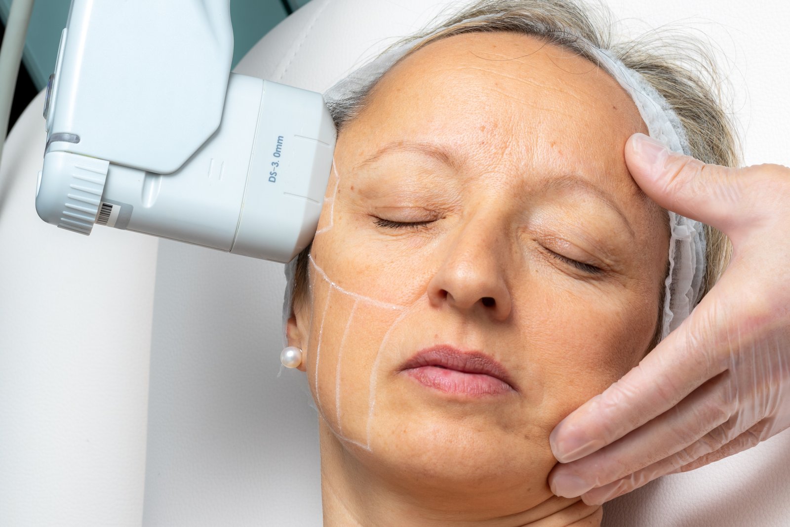 gua sha for facial rejuvenation