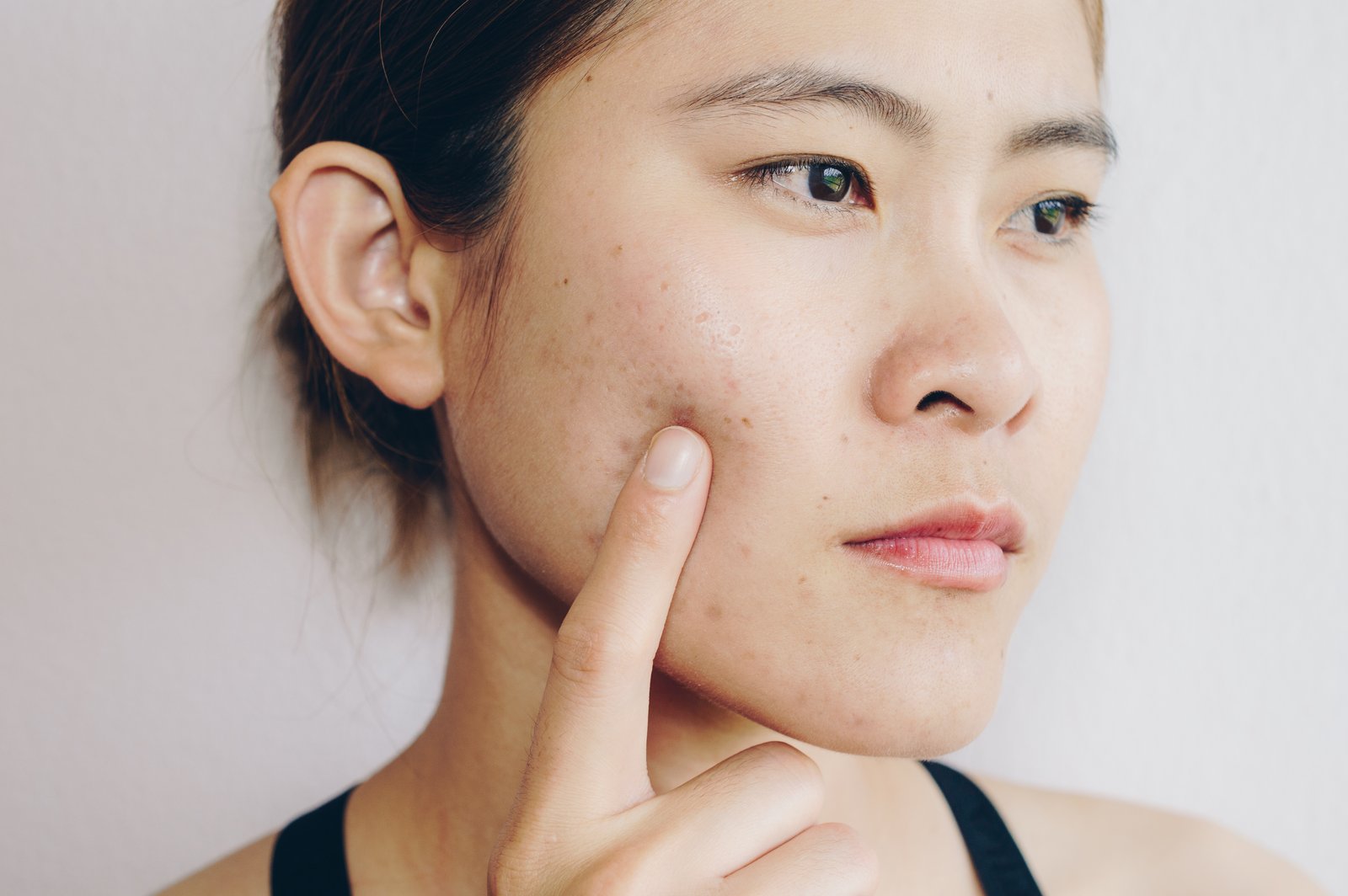 tcm hormone regulation treatment
