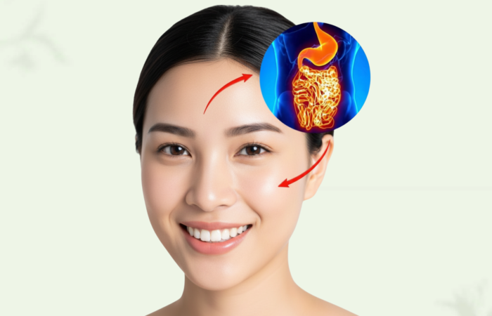 Acne Treatment Malaysia