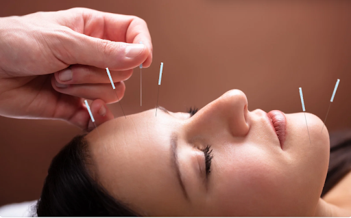 Face Acupuncture Treatment in Malaysia