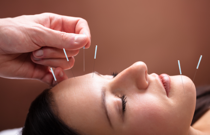 Face Acupuncture Malaysia