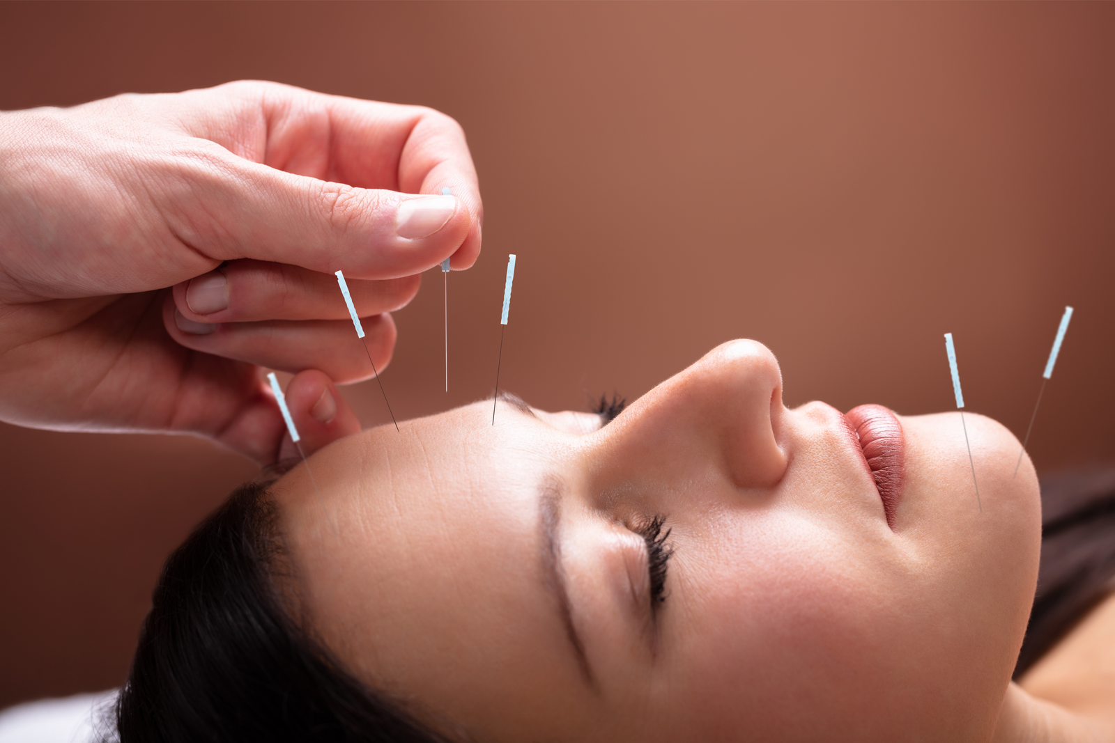 Face Acupuncture Malaysia